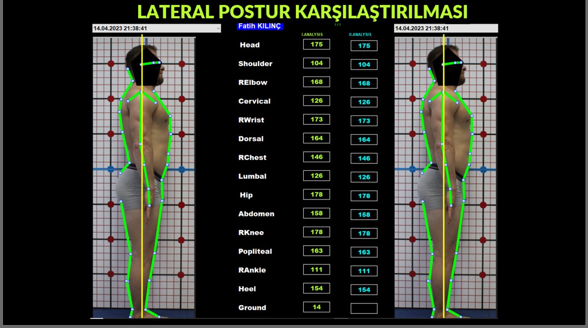 Lateral Postür Karşılaştırma